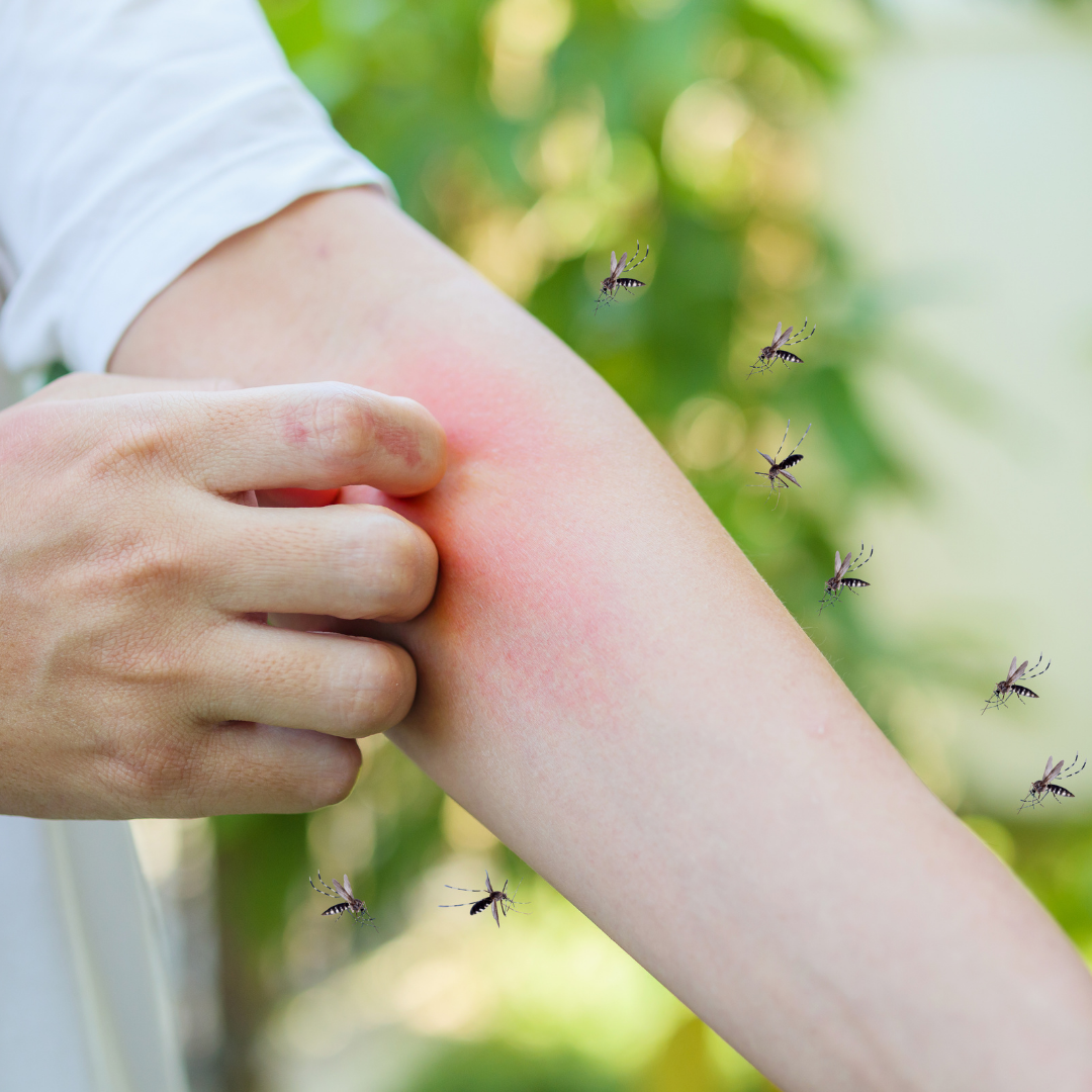 Person scratching a red mosquito bite on their arm with mosquitoes flying nearby.